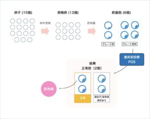 着床前診断PGSの流れ